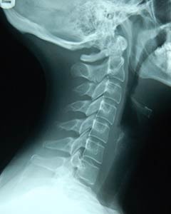 spine-specialist-in-costa-mesa-orange-county-orthopedic-clinic-3