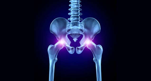 Outpatient-Total-Joint-Replacement-Orange-County-Orthopedic-Clinic-4