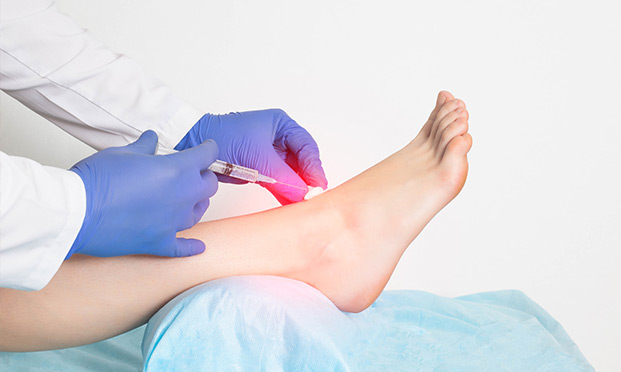 Ankle-Joint-Injection