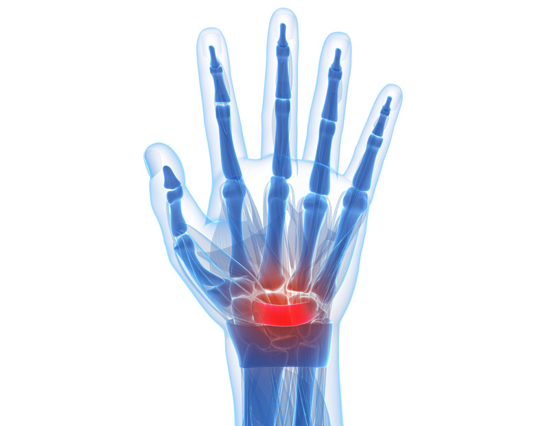 Hand-Doctor-in-Costa-Mesa-Orange-County-Orthopedic-Clinic-2