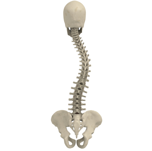 Scoliosis-Orange-County-Orthopedic-Clinic